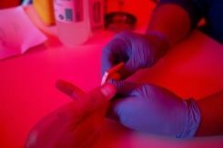 La précarité, un moteur de l'épidémie de VIH en Guyane 