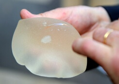 Prothèses mammaires PIP : le tribunal de commerce accorde de 6.000 à 47.000 euros à 371 victimes