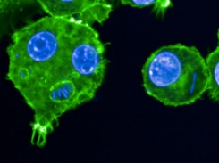 Peste, lèpre... Des chercheurs scrutent les microbes du passé
